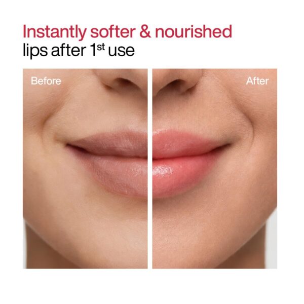 WishCare Tinted Lip Balm with SPF 50 PA+++ | Brightening Lip Balm for Dark Lips | Kojic Acid & Niacinamide | For Women | 5g (Pack of 2)